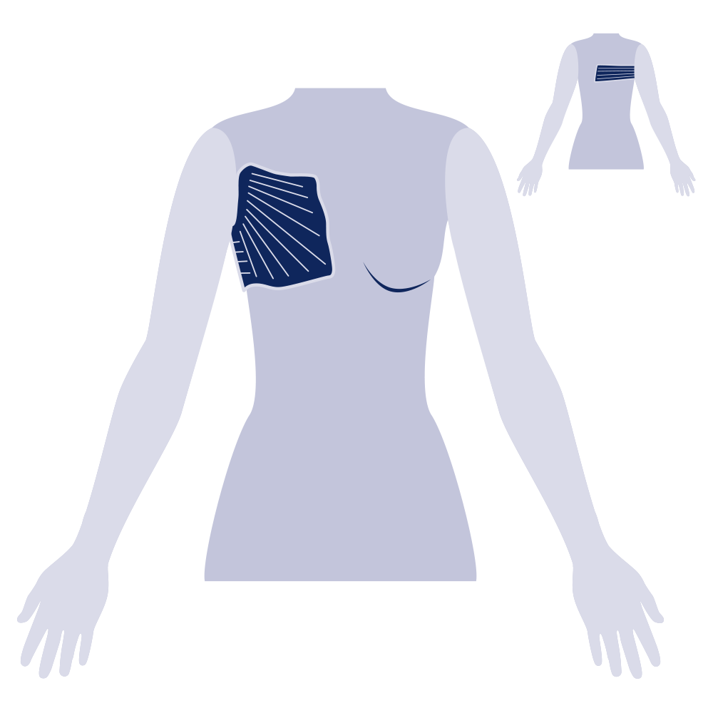 JOBST® JoViPad Breast and Chest | JOBST®